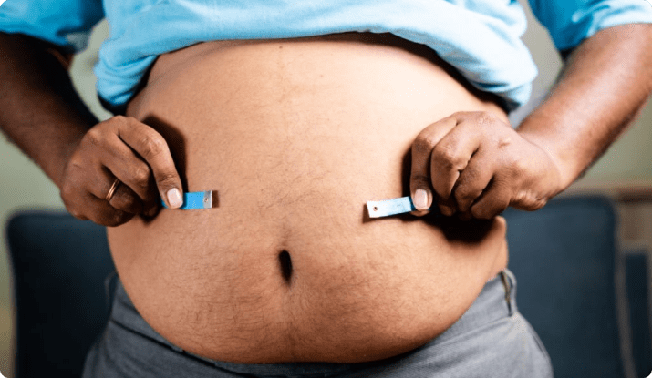 جراحات السمنة المفرطة