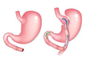 عمليه تحويل المسار 