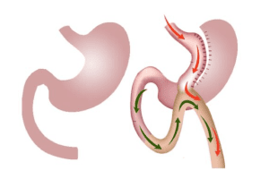 عملية الساسي